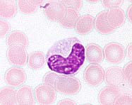 单核细胞 单核细胞