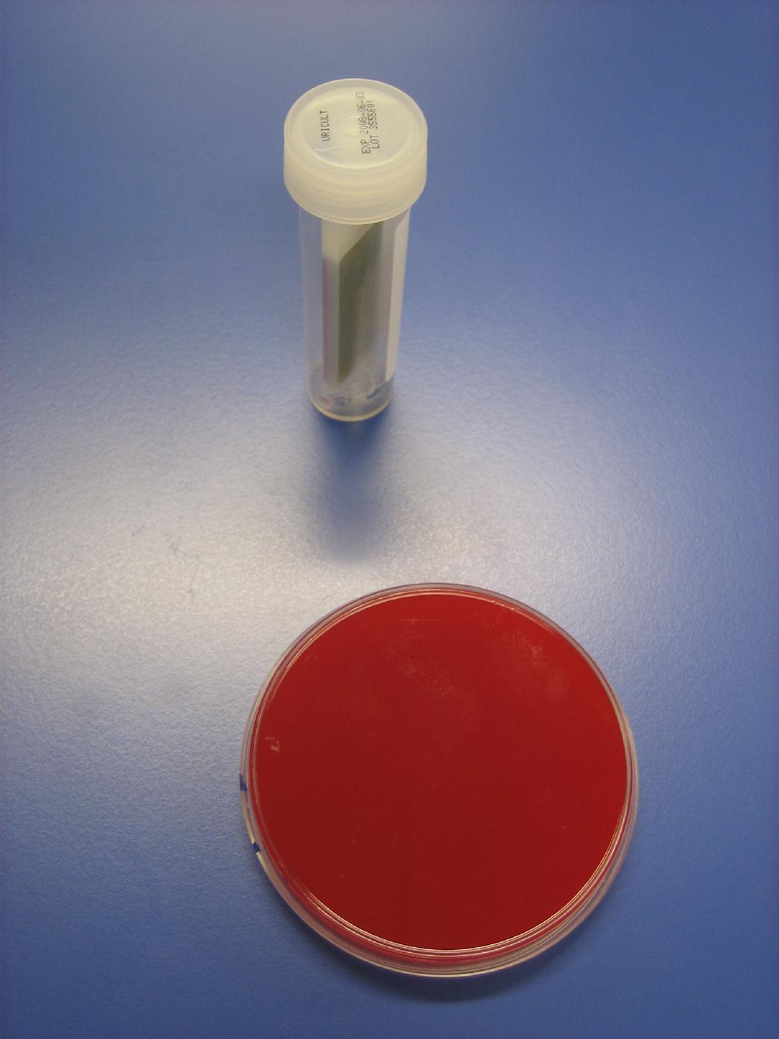 血琼脂      (1) 血琼脂( blood agar) ,25℃及37℃下培养